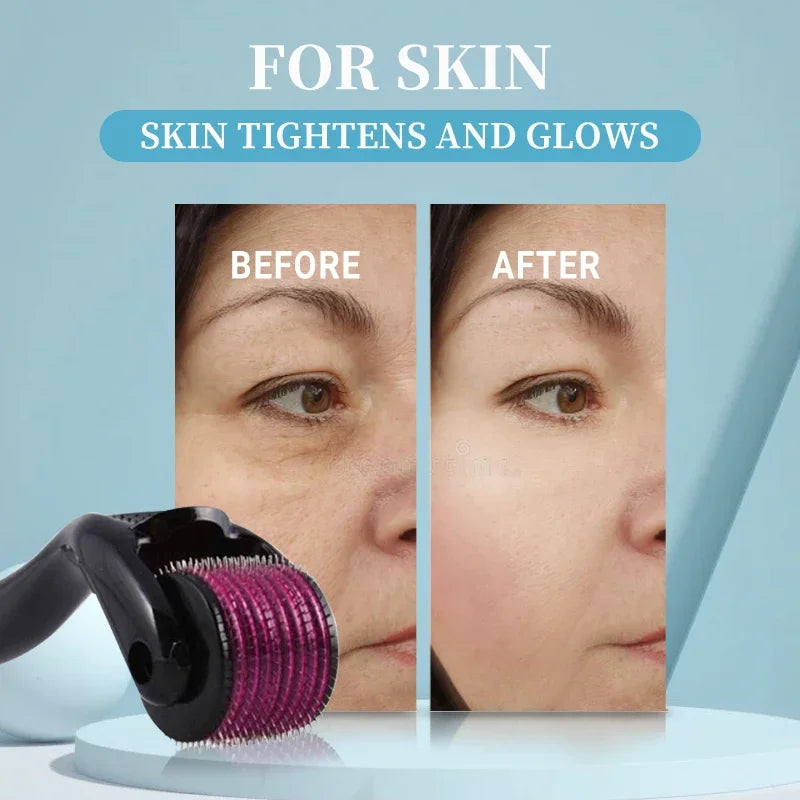 1PC Skin Care Beauty Lifting Contouring Tool 540 Roller 0.3mm Face Massager Facial Roller Improve skin Reduce Acne Beauty Tools